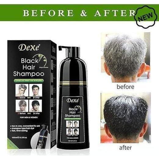 Dexe Health & Beauty Dexe Black Hair Shampoo Classic