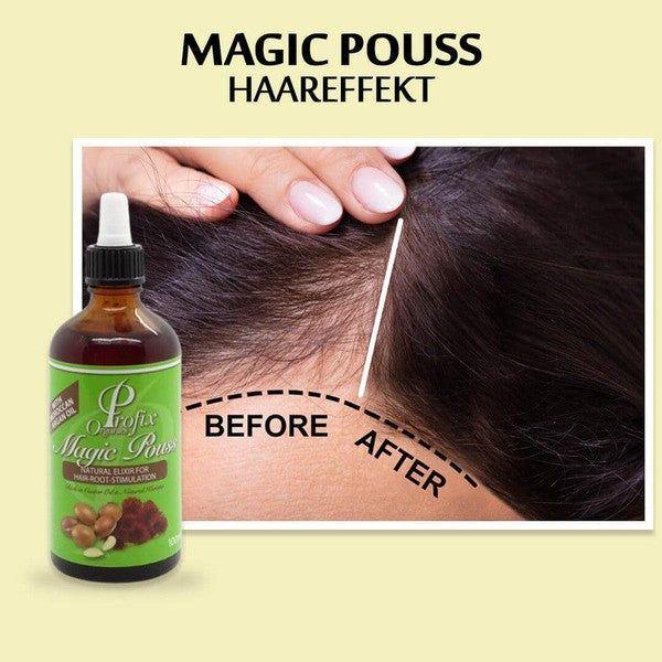 Profix Health & Beauty Profix Magic Pouss Natural Elixir for Hair-Root-Stimulation 100ml